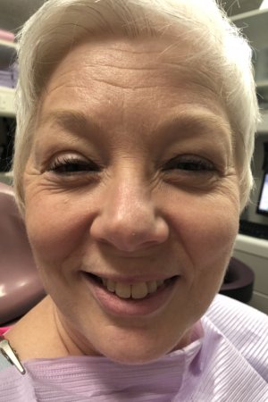 clear braces in Chesterfield MO