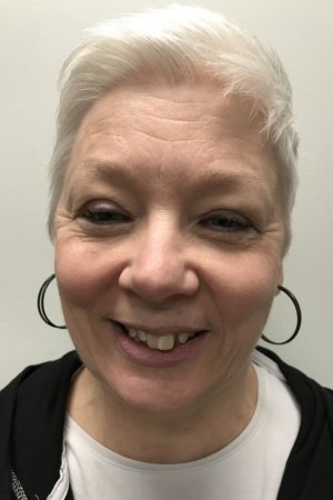 case of straight teeth in Chesterfield MO